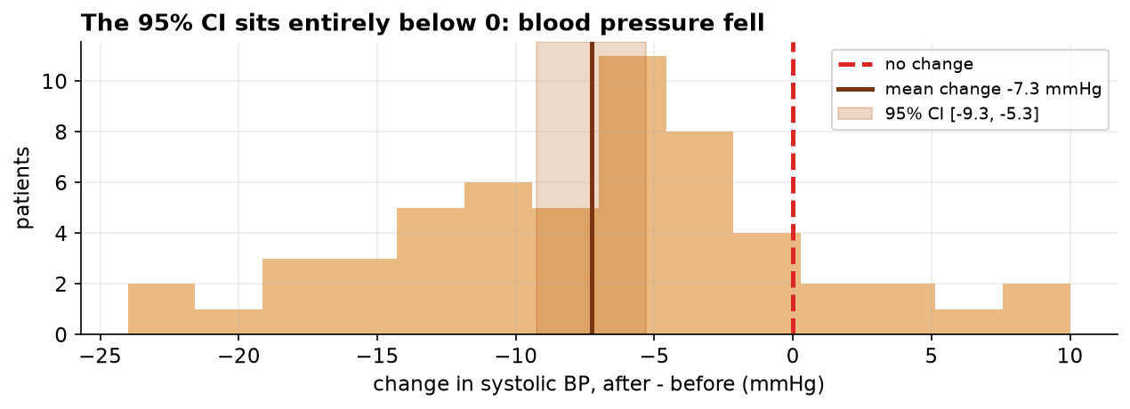 A histogram of the per-patient changes in systolic blood pressure. A dashed red line marks zero (no change). A solid dark line marks the mean change at about minus 7 mmHg, and a shaded gold band spanning minus 9.3 to minus 5.3 mmHg marks the 95% confidence interval. The entire band lies to the left of zero.